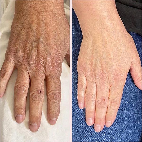 Flawless Laser & Body Sculpting