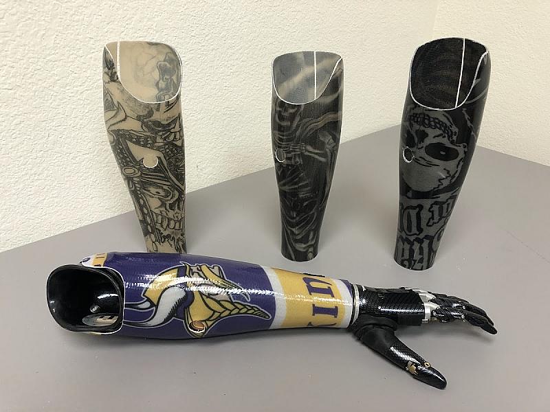 Evolve Prosthetics & Orthotics