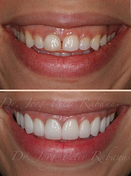 Dr. Jorg-Peter Rabanus DDS