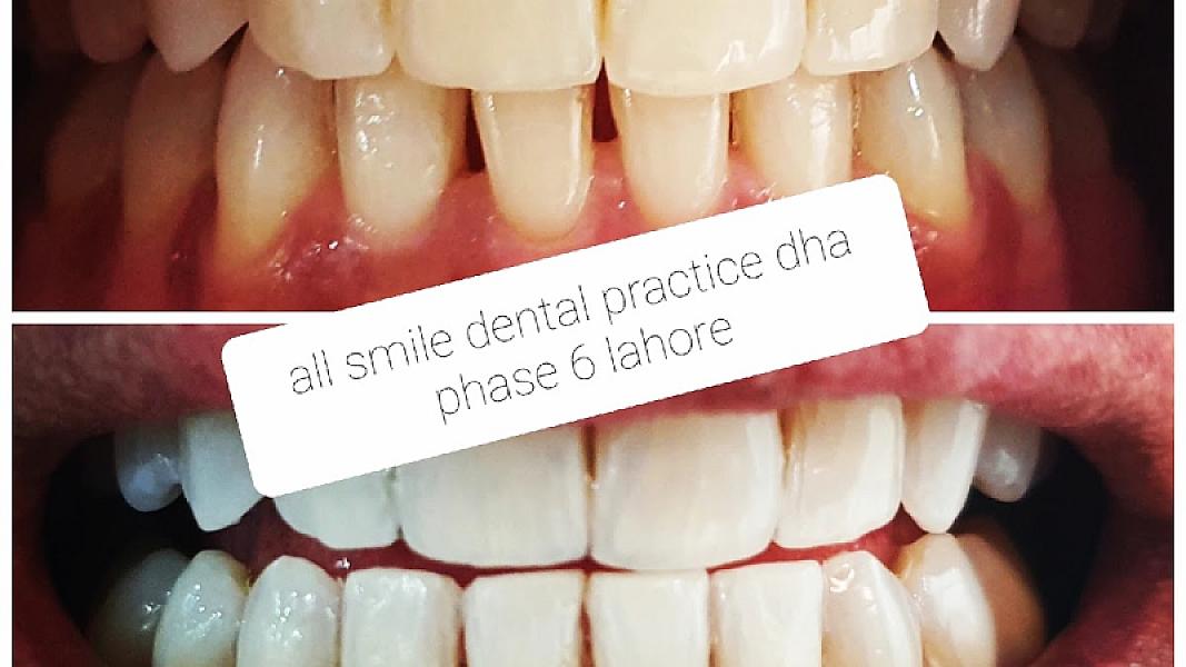 All Smiles Dental