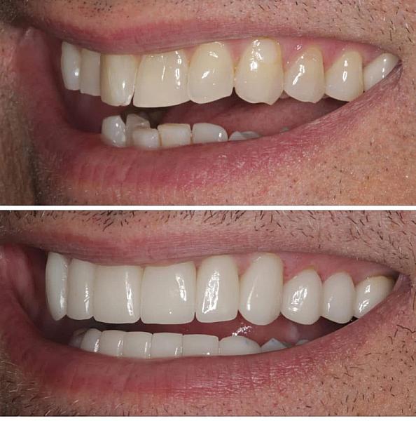 Cosmetic Dentist Joshua Bernstein DDS
